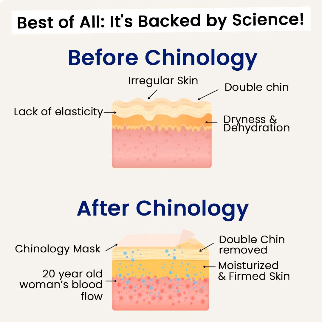 The Chinology™ Lift - Black Friday Deal