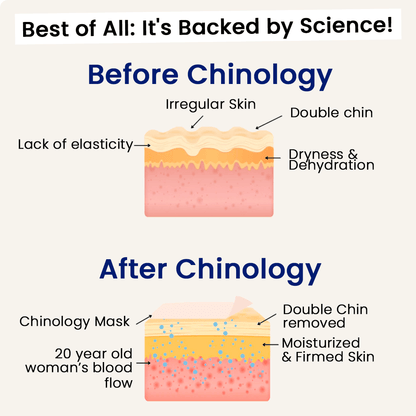 The Chinology™ Lift  - Black Friday Deal